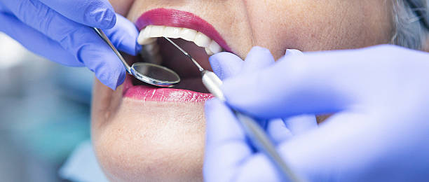 Best Emergency Tooth Extraction in Porters Neck, NC